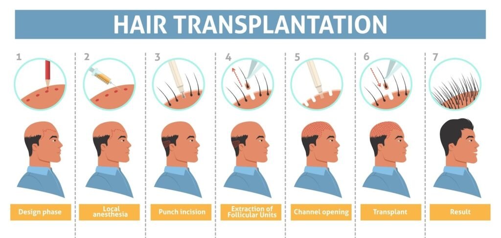 top hair transplant in jammu