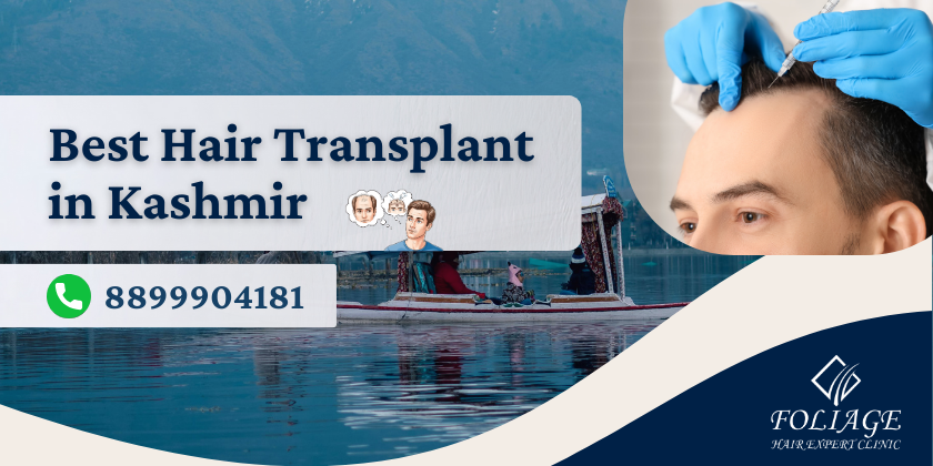 Best Hair Transplant in Kashmir