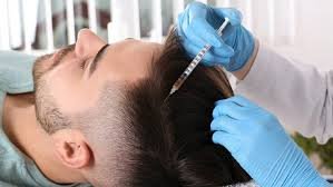 Bio Sapphire Hair Transplant