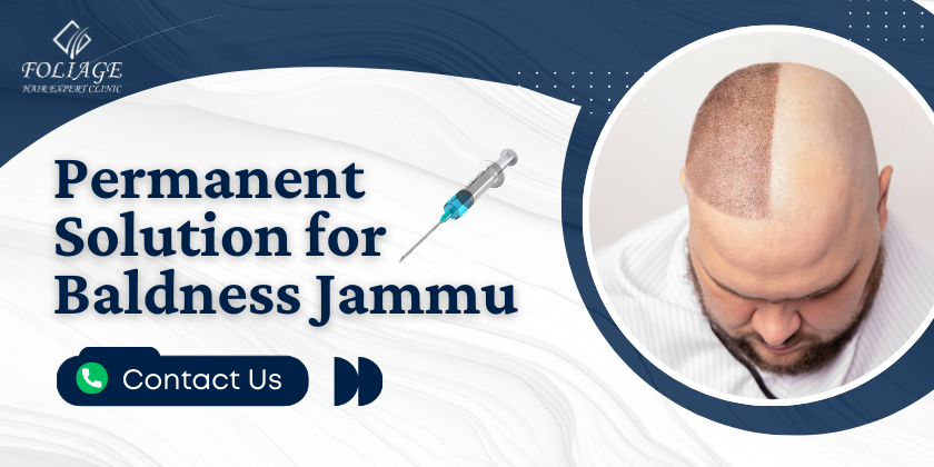 Permanent Solution for Baldness in Jammu
