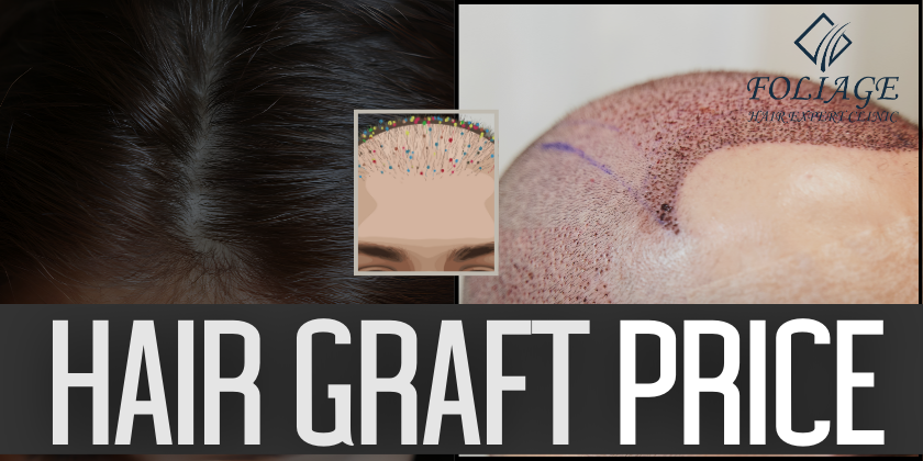 hair graft price in 2026