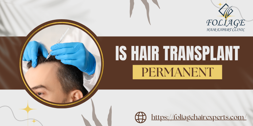 is hair transplant permanent